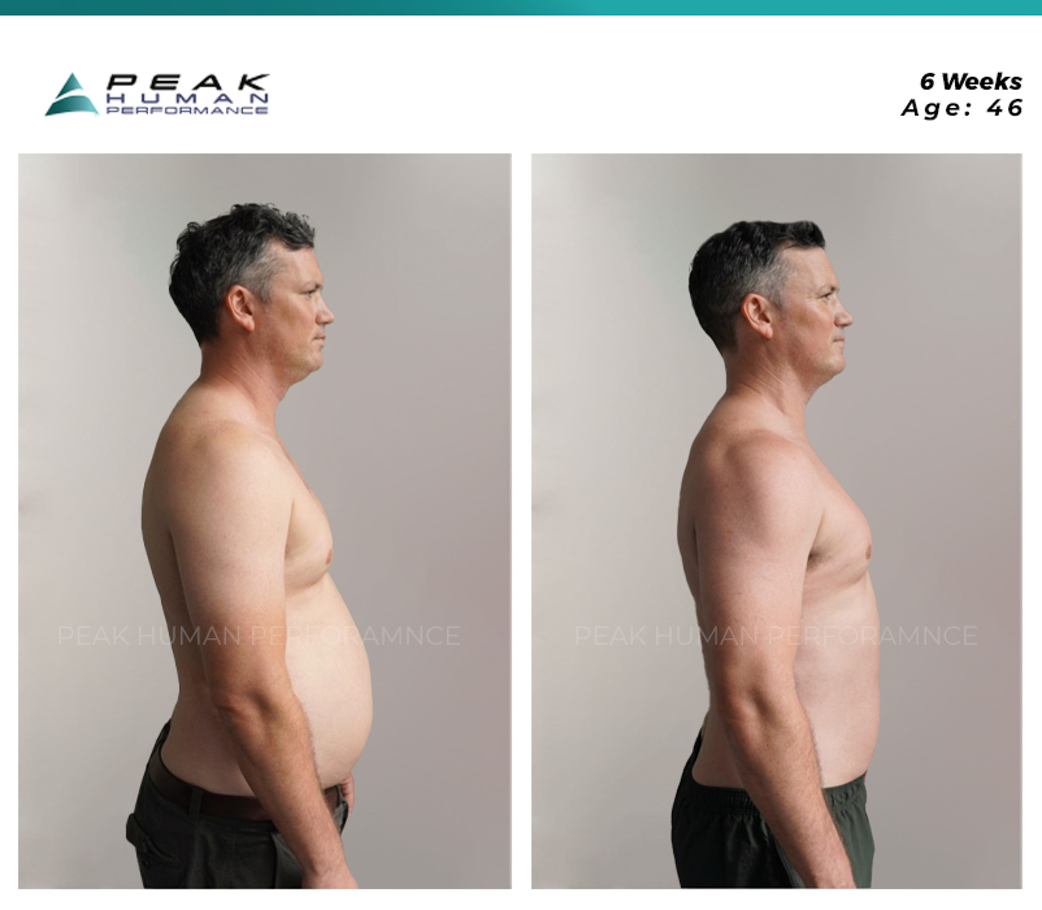 PHP - B&A - James - Right