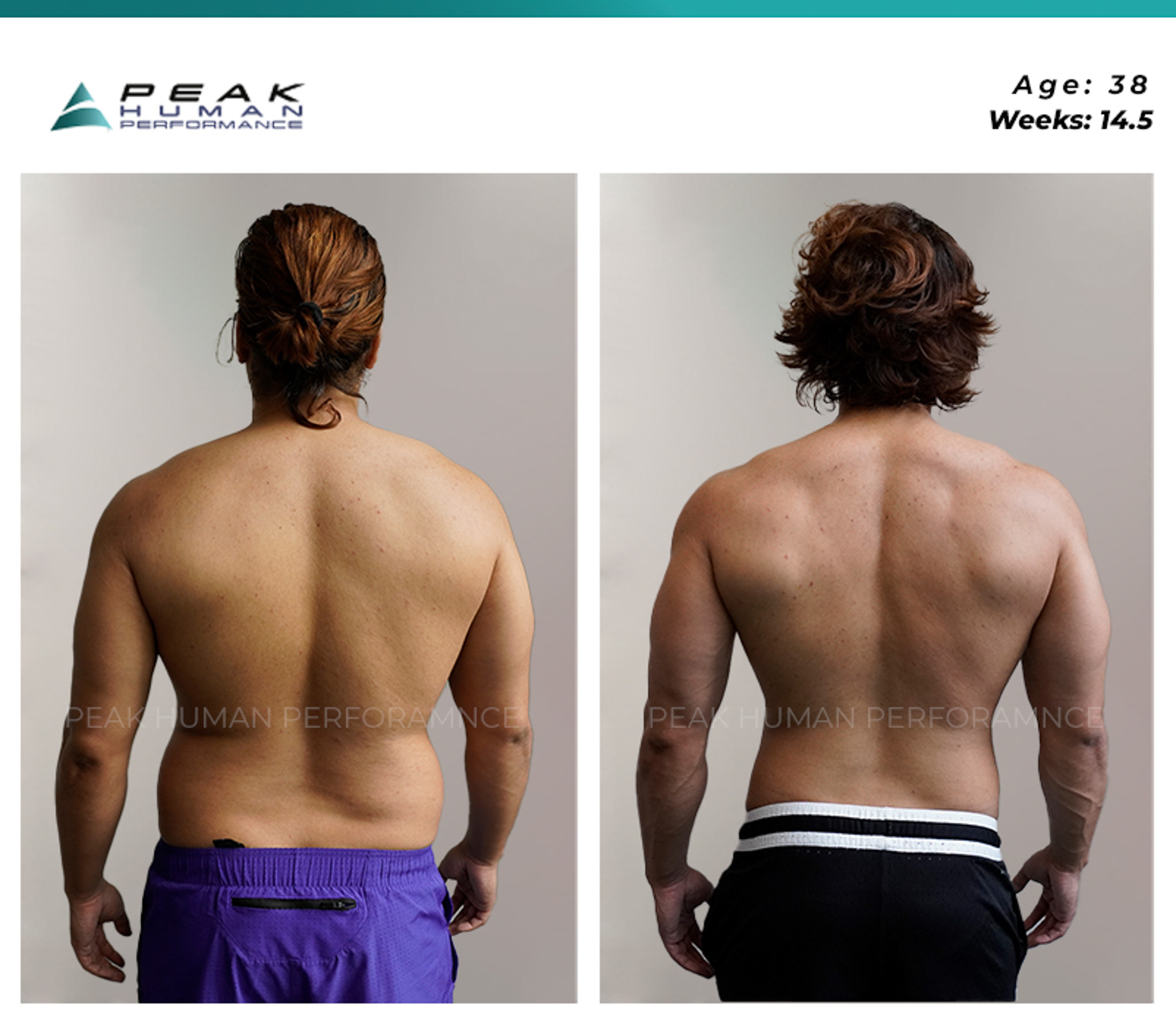 PHP - B&A June Back type