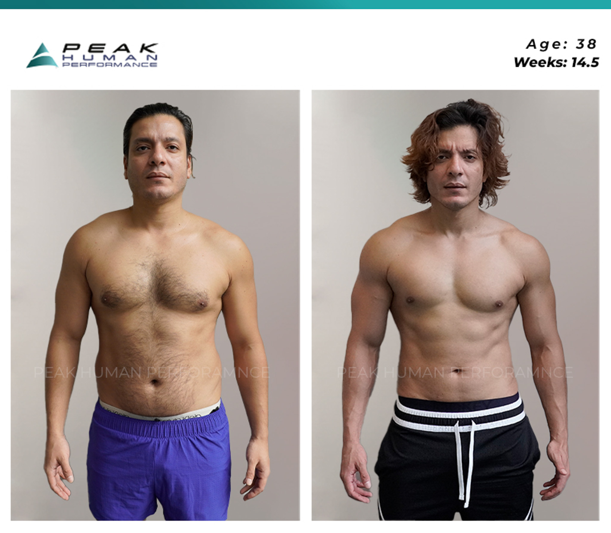 PHP - B&A June front type