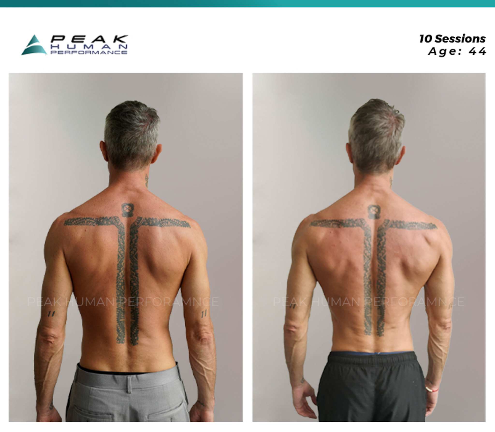 PHP - B&A - Mauri - Back