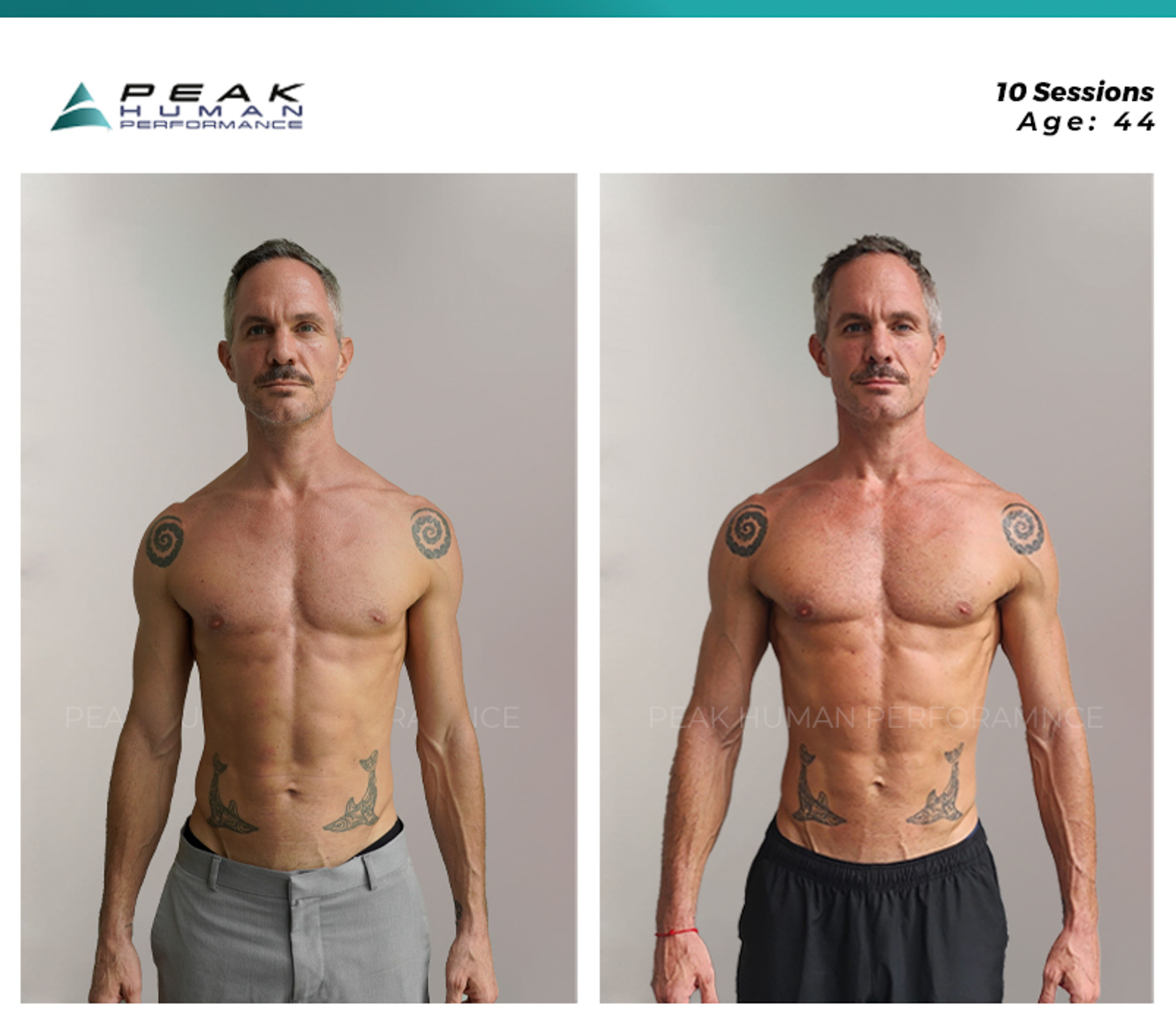 PHP - B&A - Mauri - Front