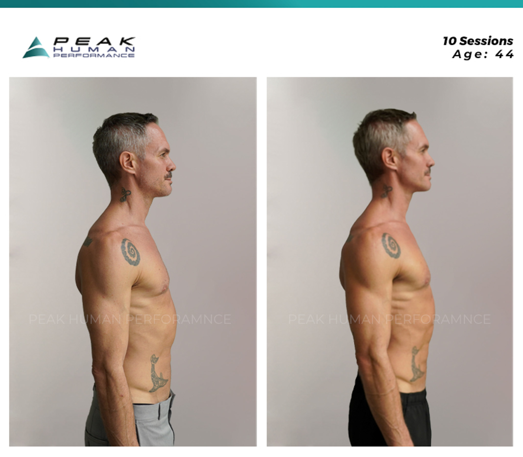 PHP - B&A - Mauri - Right